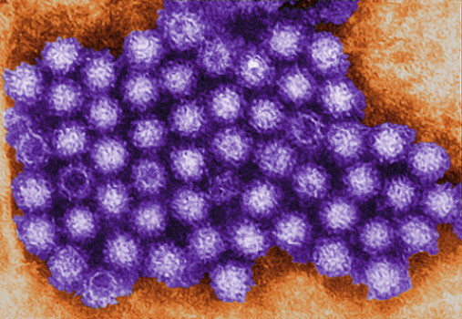 In two studies in Science, researchers at Washington University School of Medicine in St. Louis identify promising new methods for controlling outbreaks of norovirus (shown above), a common cause of serious gastrointestinal illness. Credit: Charles D. Hum