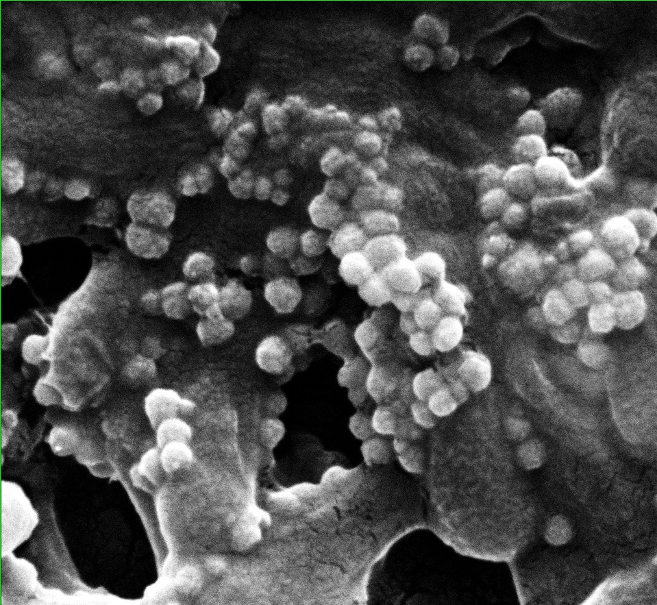 Bacteriophages combined with nanoparticle clusters can be drawn into a biofilm with a magnet.  Courtesy of the Alvarez Group