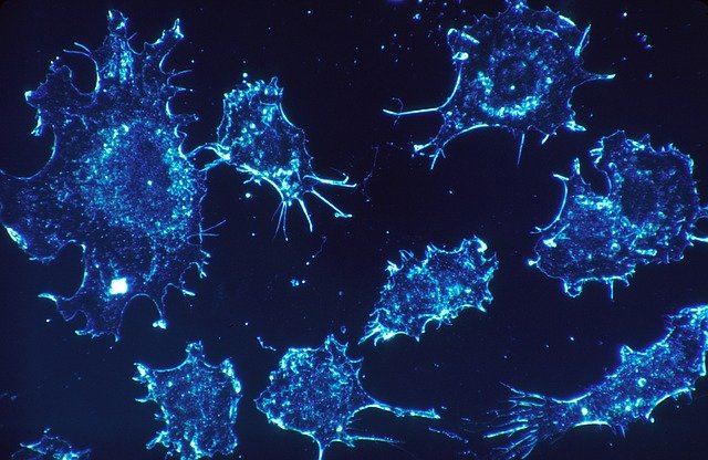 Cancer cells. Credit: pixabay.com